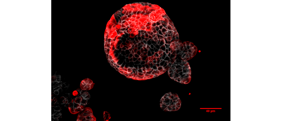 Colorectal cancer organoid with residual cells responsible for relapse marked in red. (IRB Barcelona)